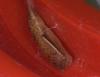 Cyclophora sp.